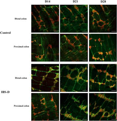 Patchouli alcohol improved diarrhea-predominant irritable bowel syndrome by regulating excitatory neurotransmission in the myenteric plexus of rats